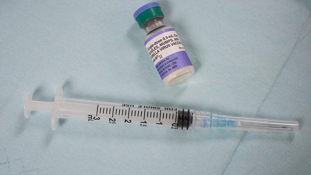 Measles 